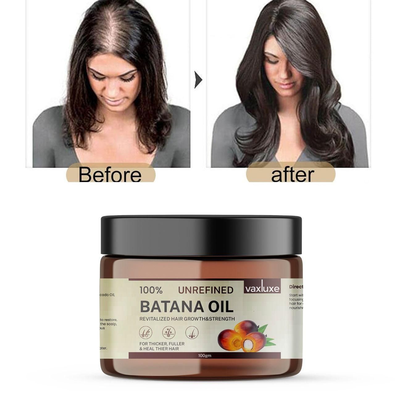 Vaxluxe Batana Oil – Hair Growth & Strengthening Oil