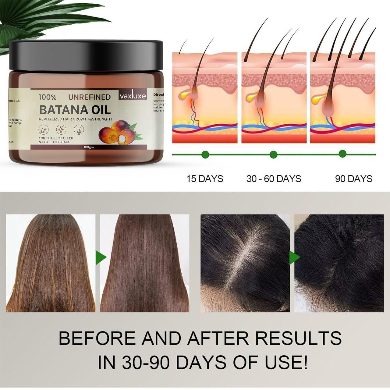 Vaxluxe Batana Oil – Hair Growth & Strengthening Oil