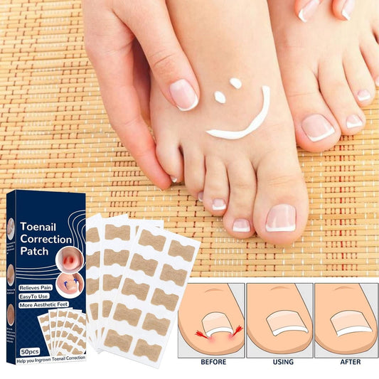 Ingrown Toenail Correction Stickers – Pain Relief & Nail Alignment (Pack of 1)